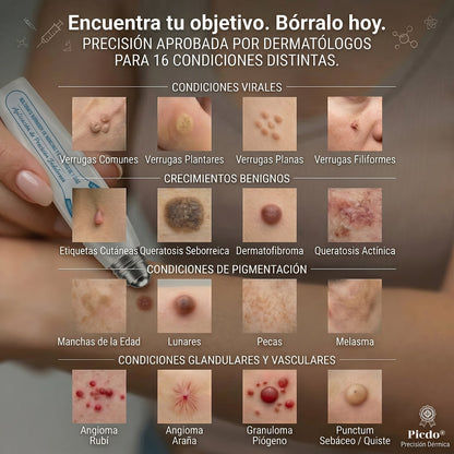 🏥🛒𝐏𝐢𝐜𝐝𝐨®  Borrador de Verrugas y Manchas en 7 Días (𝐀𝐩𝐥𝐢𝐜𝐚𝐝𝐨𝐫 𝐫𝐨𝐥𝐥-𝐨𝐧: 𝐬𝐢𝐧 𝐝𝐨𝐥𝐨𝐫 𝐧𝐢 𝐜𝐢𝐜𝐚𝐭𝐫𝐢𝐜𝐞𝐬)