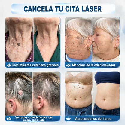 🏥🛒𝐏𝐢𝐜𝐝𝐨®  Borrador de Verrugas y Manchas en 7 Días (𝐀𝐩𝐥𝐢𝐜𝐚𝐝𝐨𝐫 𝐫𝐨𝐥𝐥-𝐨𝐧: 𝐬𝐢𝐧 𝐝𝐨𝐥𝐨𝐫 𝐧𝐢 𝐜𝐢𝐜𝐚𝐭𝐫𝐢𝐜𝐞𝐬)