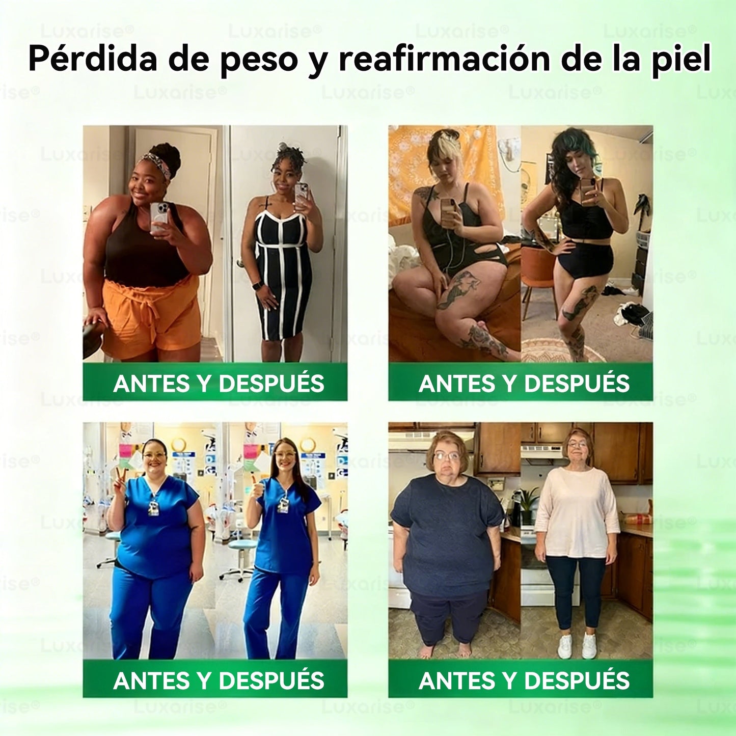𝑻𝒊𝒆𝒏𝒅𝒂 𝑶𝒇𝒊𝒄𝒊𝒂𝒍  |👩‍⚕️🍒𝑳𝒖𝒙𝒂𝒓𝒊𝒔𝒆® 10 𝑬𝑵 1 𝑴𝒐𝒓𝒊𝒏𝒈𝒂 𝒀 𝑩𝒆𝒓𝒃𝒆𝒓𝒊𝒏𝒂 𝑷𝒂𝒓𝒄𝒉𝒆 𝑨𝒗𝒂𝒏𝒛𝒂𝒅𝒐 𝑫𝒆 𝑴𝒊𝒄𝒓𝒐𝒏𝒆𝒆𝒅𝒍𝒆𝒔 𝑵𝒂𝒏𝒐（𝑼𝒏𝒂 𝒗𝒆𝒛 𝒂𝒍 𝒅í𝒂, 𝒄𝒂𝒎𝒃𝒊𝒐𝒔 𝒗𝒊𝒔𝒊𝒃𝒍𝒆𝒔 𝒆𝒏 7 𝒅í𝒂𝒔） ✅ 𝑶𝒃𝒆𝒔𝒊𝒅𝒂𝒅, 𝑫𝒊𝒂𝒃𝒆𝒕𝒆𝒔, 𝑨𝒑𝒏𝒆𝒂 𝒅𝒆𝒍 𝑺𝒖𝒆ñ𝒐 𝒚 𝑷𝒓𝒐𝒃𝒍𝒆𝒎𝒂𝒔 𝑨𝒓𝒕𝒊𝒄𝒖𝒍𝒂𝒓𝒆𝒔