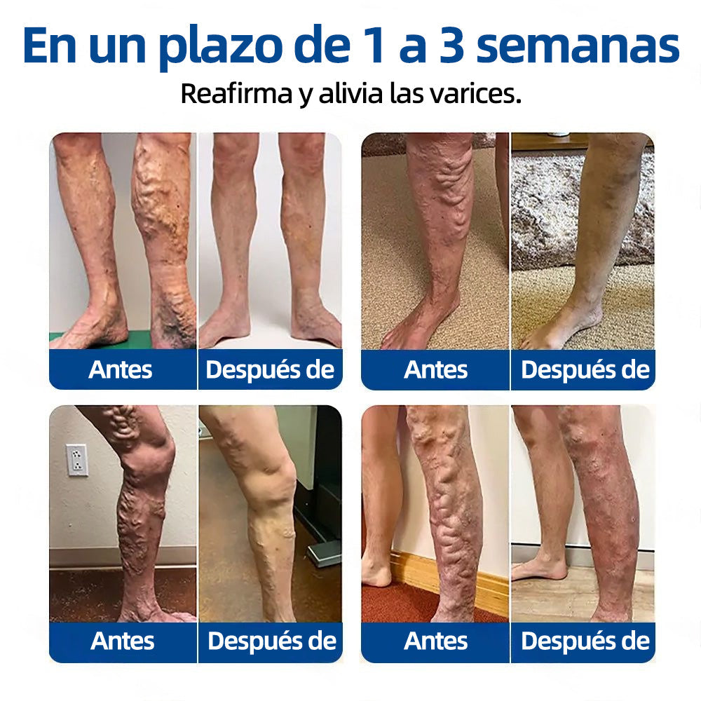 ✅𝐅𝐥𝐨𝐫𝐢𝐬𝐦𝐚®𝐎𝐛𝐣𝐞𝐭𝐢𝐯𝐨 𝐕𝐞𝐧𝐨𝐬𝐨 𝐏𝐚𝐫𝐜𝐡𝐞 𝐃𝐞 𝐌𝐢𝐜𝐫𝐨𝐚𝐠𝐮𝐣𝐚𝐬🩹🩹⚡Alivio instantáneo, resultados a largo plazo