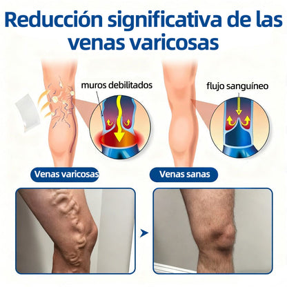 ✅𝐅𝐥𝐨𝐫𝐢𝐬𝐦𝐚®𝐎𝐛𝐣𝐞𝐭𝐢𝐯𝐨 𝐕𝐞𝐧𝐨𝐬𝐨 𝐏𝐚𝐫𝐜𝐡𝐞 𝐃𝐞 𝐌𝐢𝐜𝐫𝐨𝐚𝐠𝐮𝐣𝐚𝐬🩹🩹⚡Alivio instantáneo, resultados a largo plazo